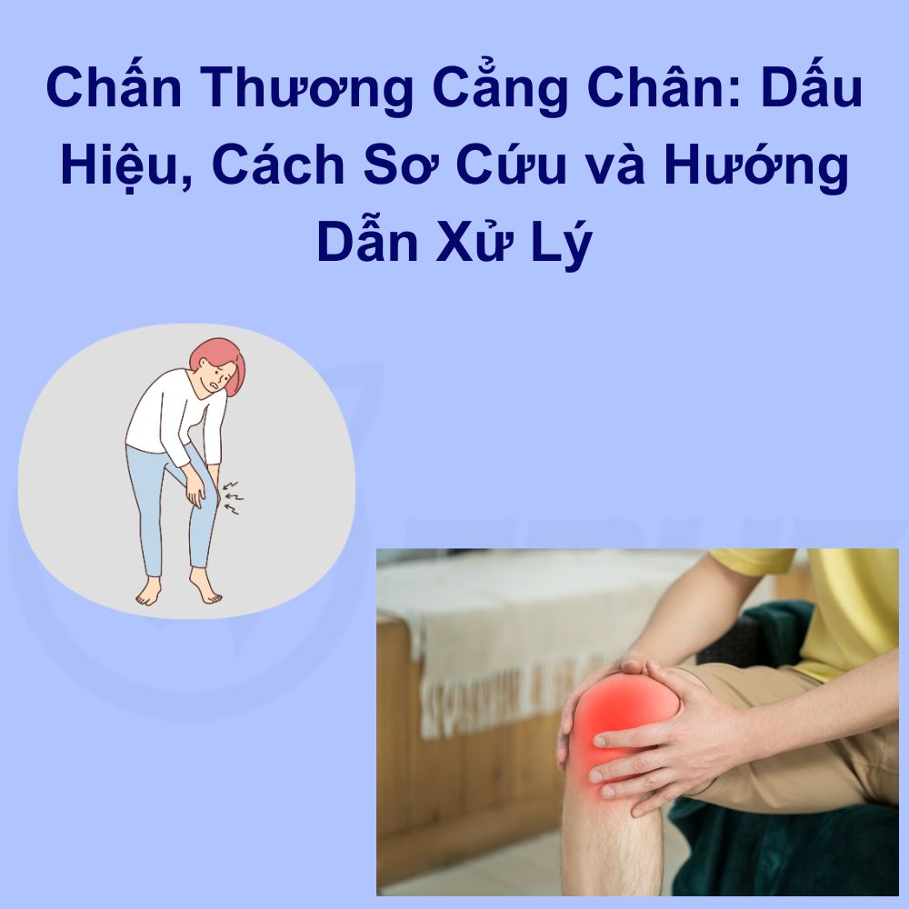 Chấn Thương Cẳng Chân: Dấu Hiệu, Cách Sơ Cứu và Hướng Dẫn Xử Lý